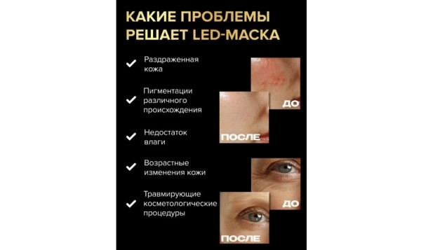Рейтинг лучших аппаратов для LED-терапии на 2025 год Рейтинг лучших аппаратов для LED-терапии на 2025 год